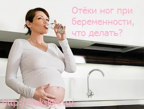 як лікувати набряки ніг при вагітності
