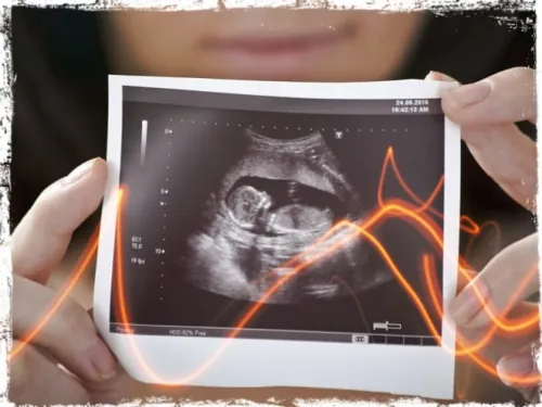 десятий тиждень вагітності фото