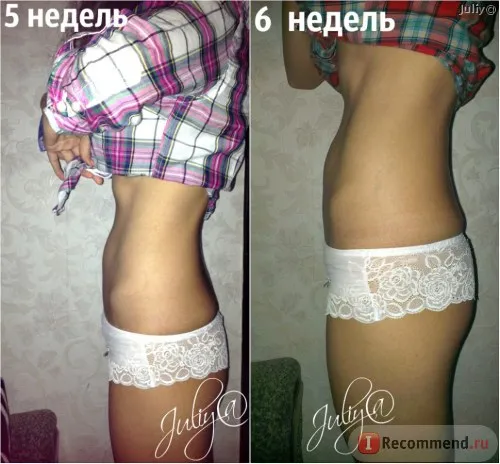 вагітність і пологи фото