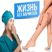 варикоз при вагітності варикоз при вагітності