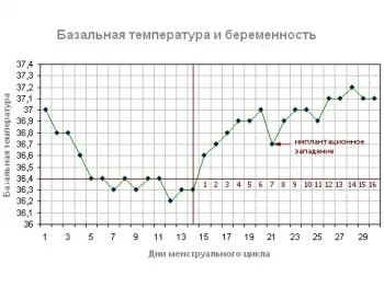 яка температура при вагітності