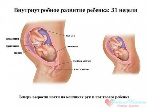 все про вагітність 31 тиждень, 31 тиждень вагітності все про вагітність 31 тиждень