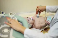 узі при вагітності на ранніх термінах