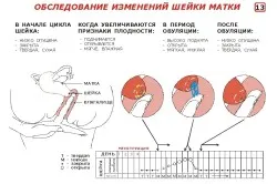 болі внизу живота на перших тижнях вагітності