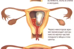 перший по підлозі