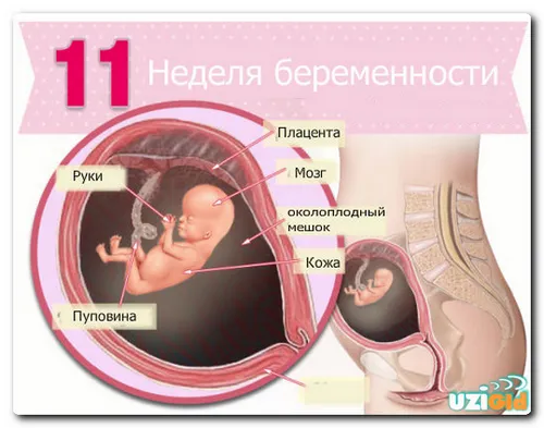 11 тиждень вагітності узі