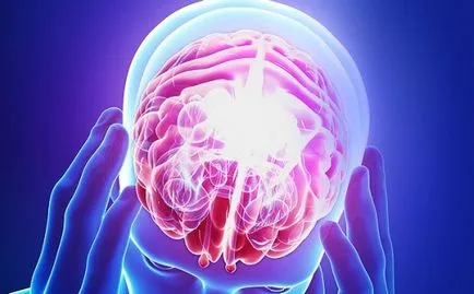 Dificultatea de a fluxului venos simptome cerebrale, tratament