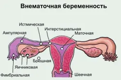 вагітність 2 місяці, перший по підлозі вагітність 2 місяці