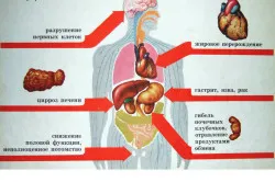 як лікувати безсоння після запою