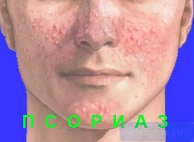 мазі