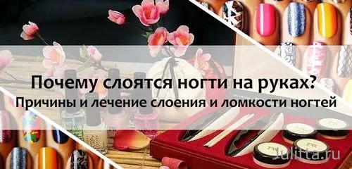 як лікувати нігті якщо вони шаруються