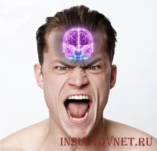 як лікувати галюцинації після інсульту