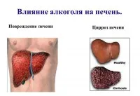 як лікувати печінку від алкоголю