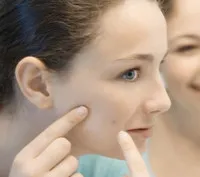 як лікувати алергію чистотілом