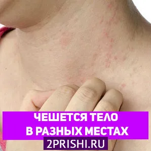 як лікувати прищі по всьому тілу