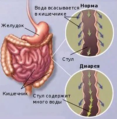 як лікувати часту діарею