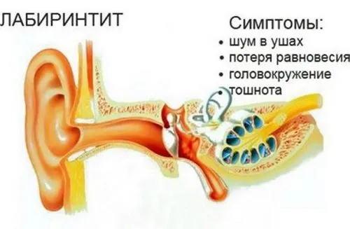 болить вухо всередині що робити ніж лікувати всередині народні засоби чому найчастіша причина чинники провокують у дітей лікувальні заходи перша допомога при гострій вушної профілактичні заходи відео