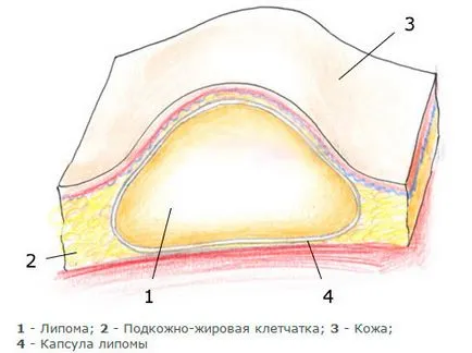 Wen sub ochii vizitează un motiv pentru a scăpa în casă, fotografii