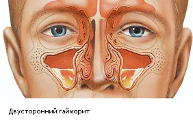 симптоми