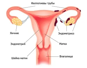 матка