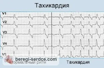 ліки