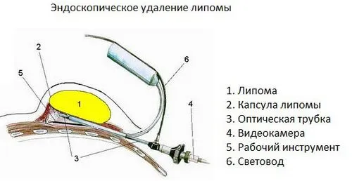 лікування