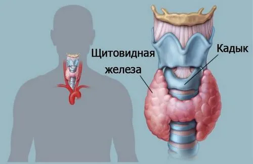 Душить щитовидка що робити як лікувати зоб горла