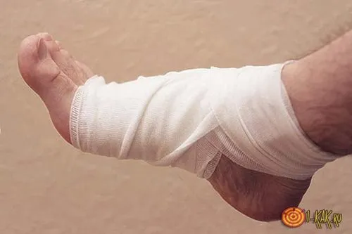 як лікувати ногу від удару