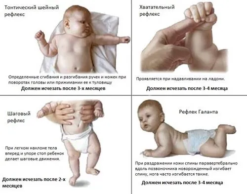 як лікувати ДЦП у дитини