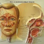 хронічний гайморит болить голова