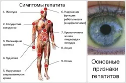 як лікувати ферменти печінки