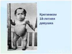 дефіцит йоду при вагітності