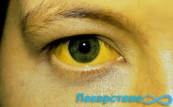 гепатит а термін лікування