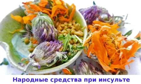 Інсульт та як його лікувати інсульт і як його лікувати