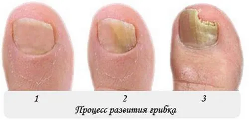 лікування
