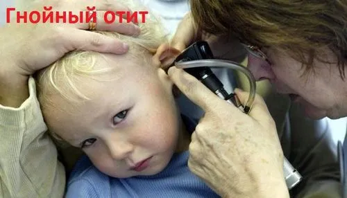 як лікувати хронічний отит у дитини