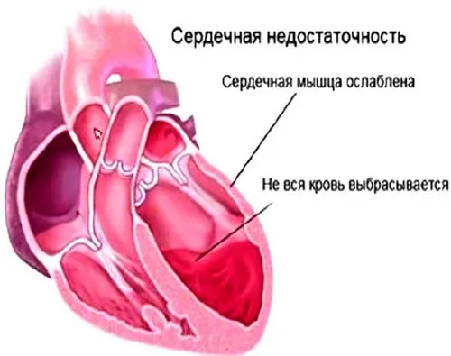 як лікувати фурункулезную ангіну
