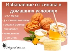 лікувати застарілий забій
