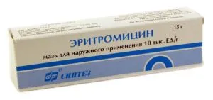 ніж лікувати стоматит при вагітності