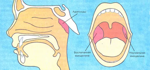 як лікувати грибкову алергію