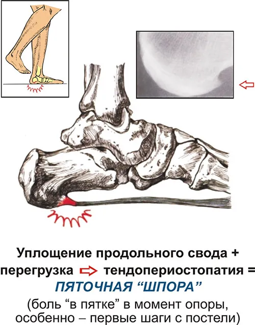 лікування