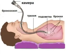 як лікувати мокротиння у дитини