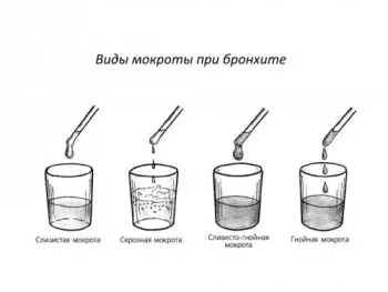 як лікувати мокротиння у дитини