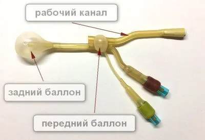 як вилікувати синусит без проколу