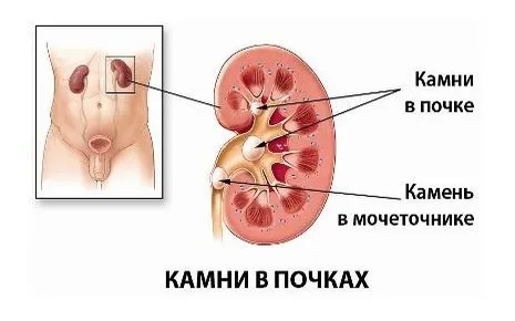 для чоловіків