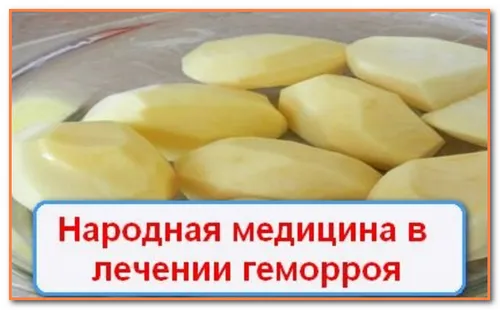 лікувати геморой домашніми засобами