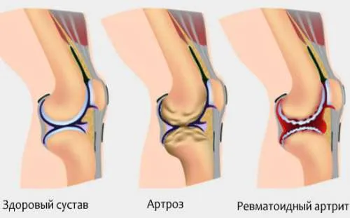 позбутися