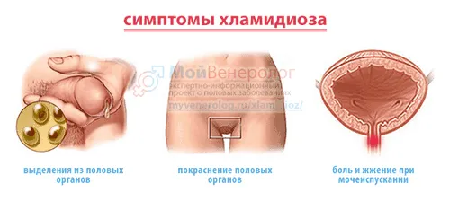 як лікувати хламідіоз жінкам