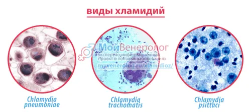 як лікувати хламідіоз жінкам