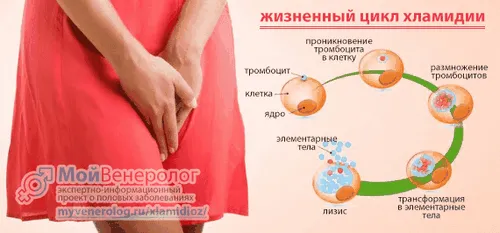 як лікувати хламідіоз жінкам